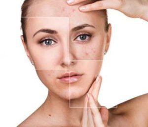 Cosmetic Dermatology is an Alternative to Surgery