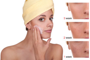 Tips to get rid of acne from My Face Near Me In Encinitas, CA