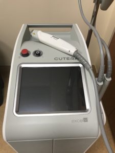How Laser Treatment Device Looks Like Near Me In Encinitas, CA