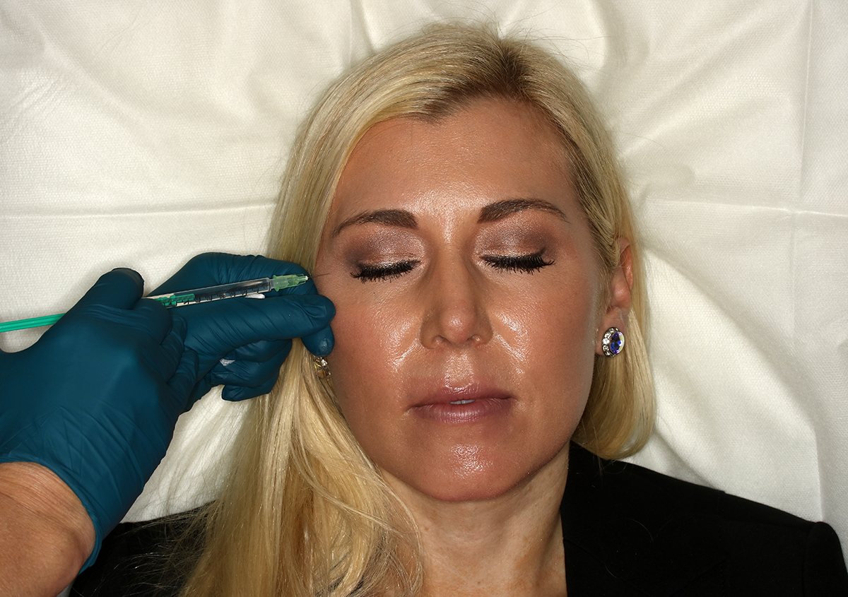 Dr. Amanda Lloyd at Skin & Vein Institute offers Botox treatment in Encinitas, CA
