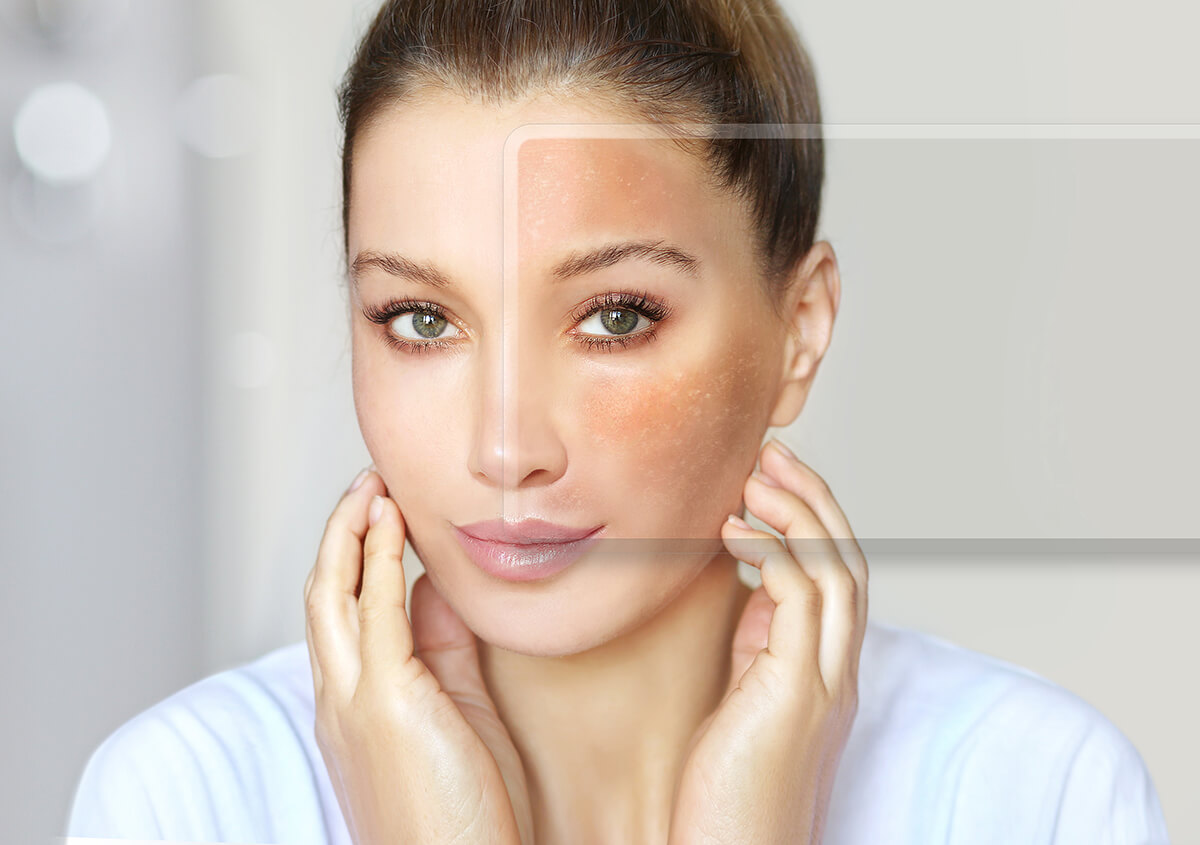 Sculptra Slowly, Naturally Reverses the Aging Process in San Diego, CA Area 